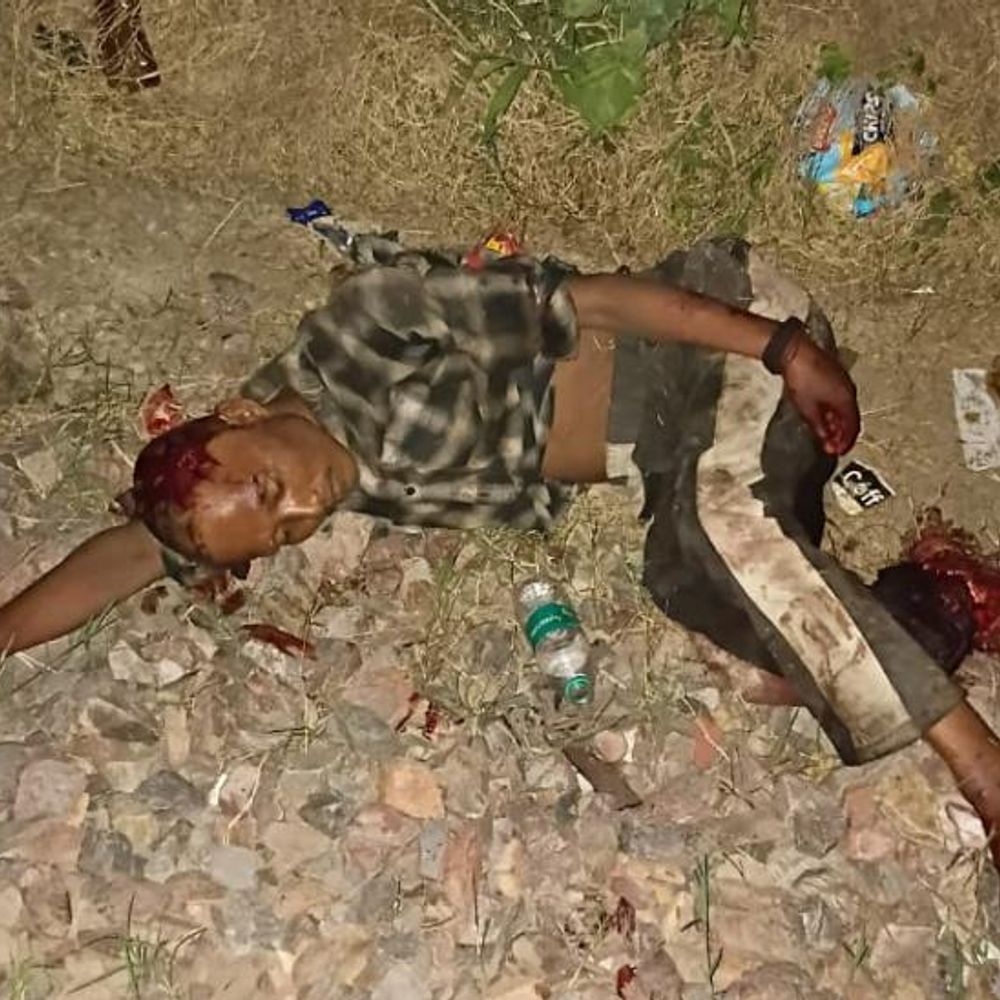 टीपीनगर में ट्रेन की चपेट में आकर एक पैर कटा:जीआरपी ने अस्पताल ले जाकर कराया भर्ती, असम निवासी सुखपाल के रूप में पहचान