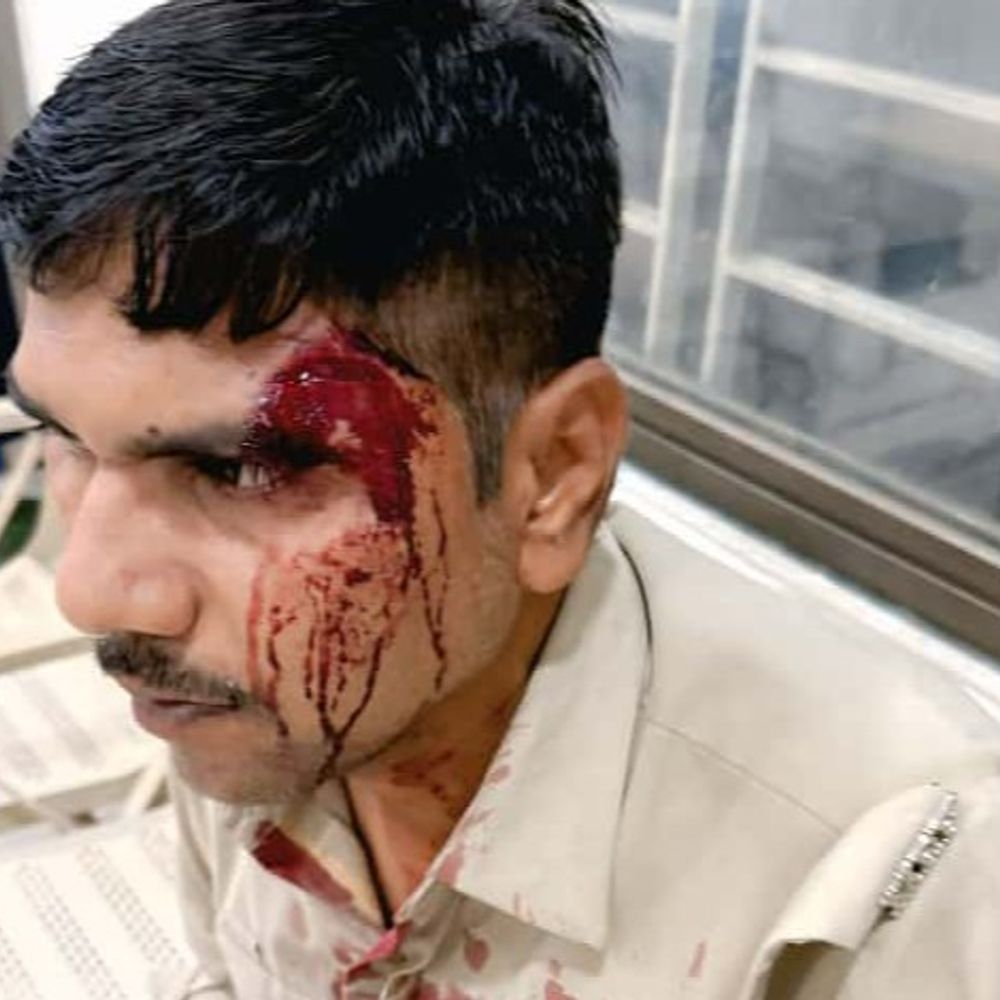 सागौन तस्करों ने वनकर्मी पर किया हमला, घायल:जंगल से लकड़ी ले जाने से रोका; बदमाश सिर पर बंदूक की बट मारकर भाग निकले