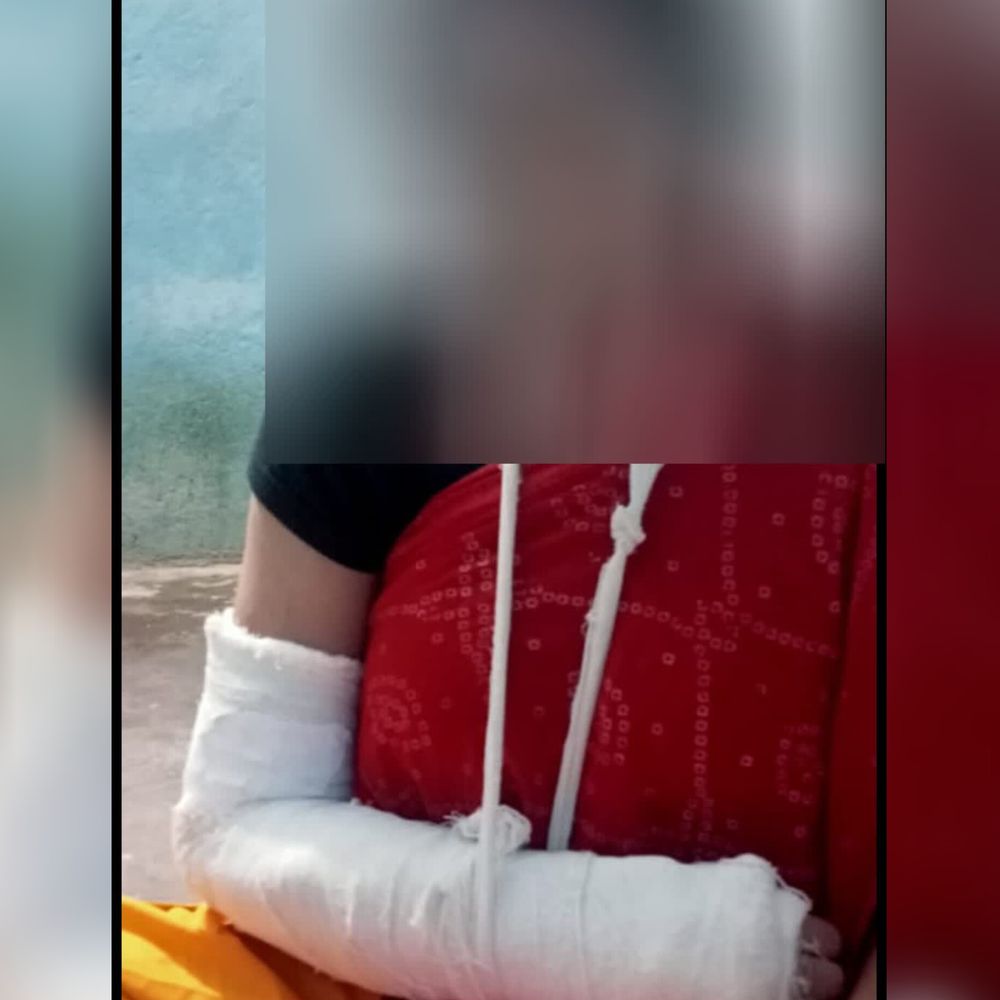 लखनऊ में पिता-बेटियों पर हमला:भाजपा कार्यकर्ता को दबंगों ने पीटा, बचाने आईं बेटियों से अभद्रता; पुलिस पर कार्रवाई में देरी का आरोप
