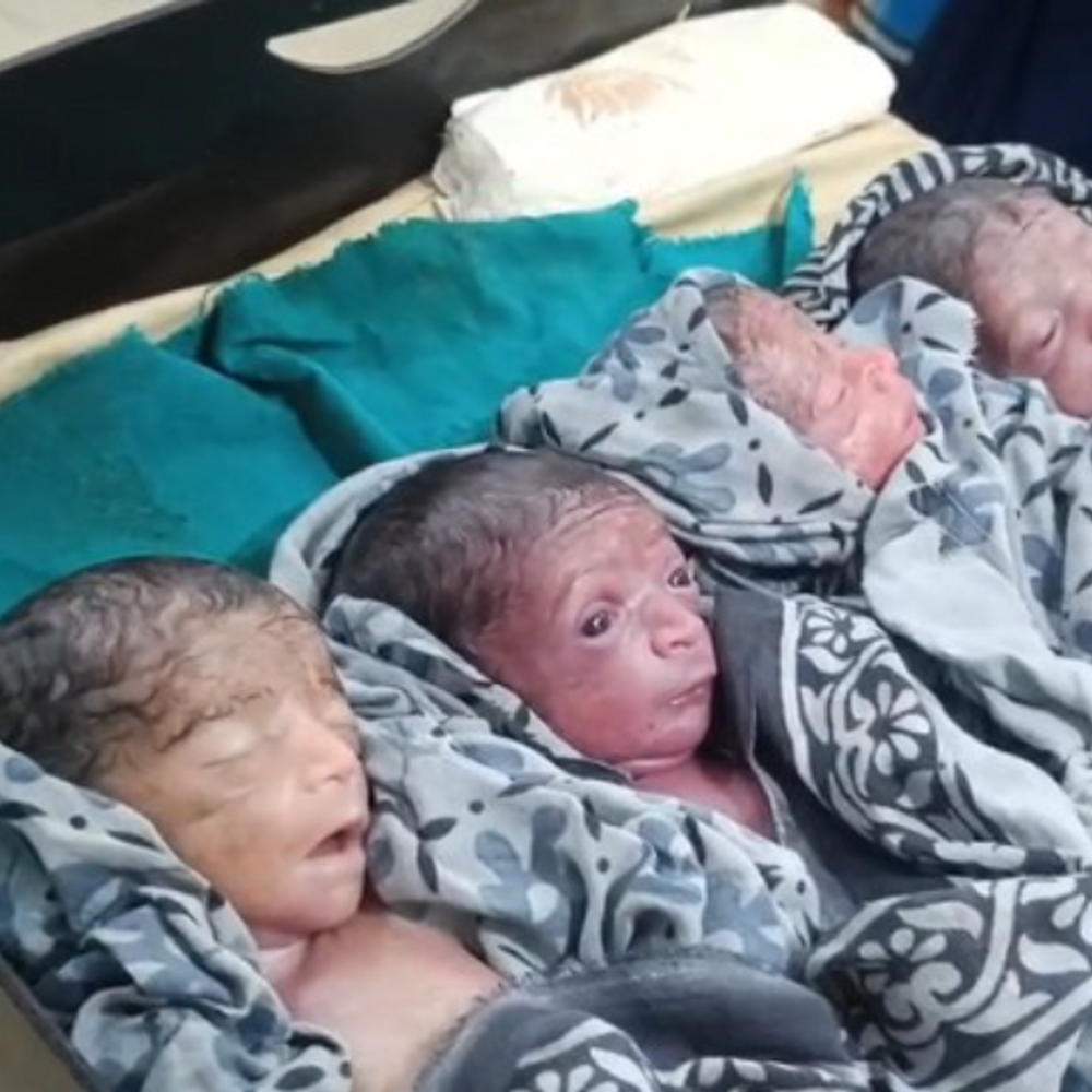 पूर्णिया में महिला ने दिया 4 बच्चों को जन्म:पहले से भी हैं चार बच्चे, डिलीवरी कराने वाली नर्स बोली- ये चमत्कार है