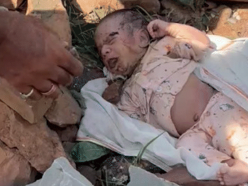 15 दिन के बच्चे को पत्थरों में फेंका, पैर जला:मुंह में पत्थर ठूंसकर होंठ फेवीक्विक से चिपकाए थे, डॉक्टर बोले-पूरी बॉडी में इंफेक्शन