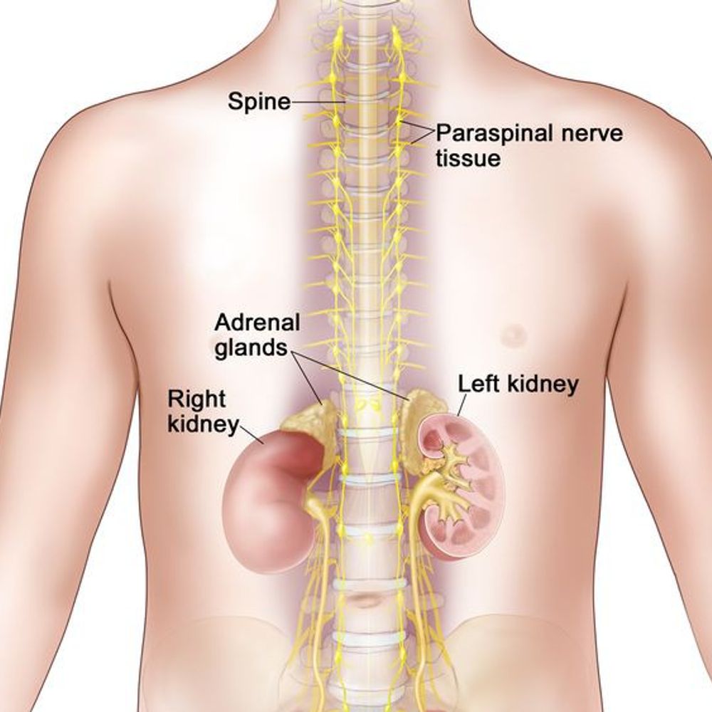 30 माह के बच्चे का हाई-रिस्क न्यूरोब्लास्टोमा ठीक:एचसीजी कैंसर सेंटर, जयपुर में ऑटोलोगस स्टेम सेल ट्रांसप्लांट से इलाज