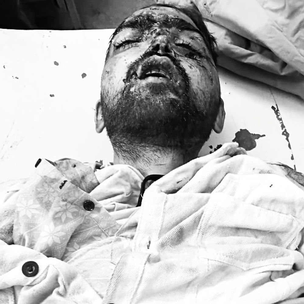 मथुरा में यमुना एक्सप्रेस-वे पर खड़ी बस से टकराई बाइक:युवक की मौत, घर से दिल्ली लौट रहा था