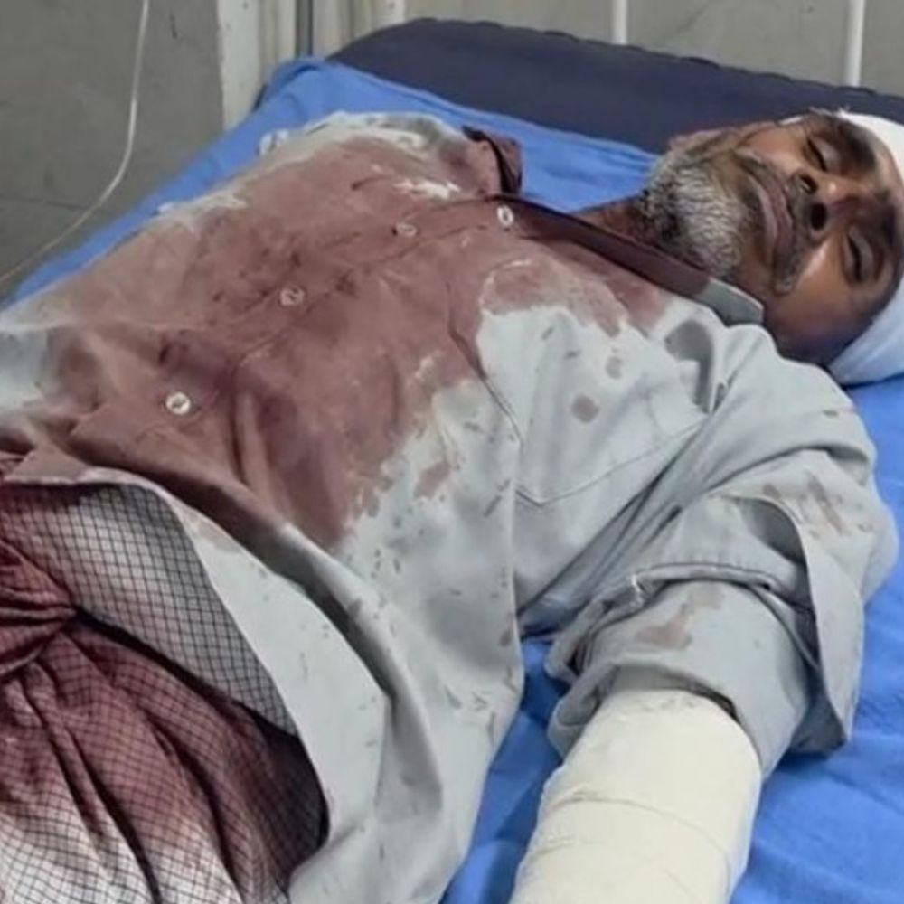 अलवर में एक ही परिवार के दो पक्षों में झगड़ा:जमीन के विवाद में जमकर चले लाठी-डंडे, एक दूसरे पर हमले में 12 लोग घायल