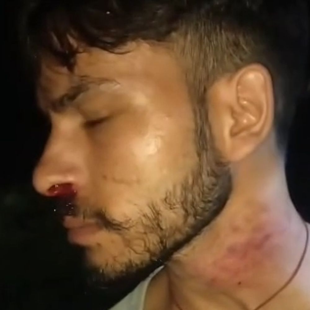 युवक पर दो नकाबपोशों ने किया हमला:शोर पर पहुंचे ग्रामीणों ने बचाई जान, देर रात तक तलाश करते रहे लोग