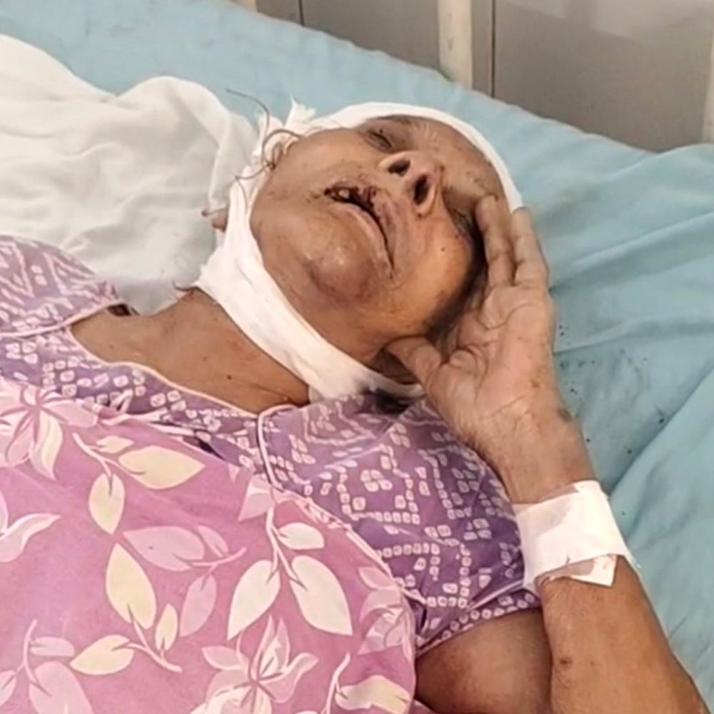 ग्वालियर में आरक्षक की मां के साथ लूट:मंदिर से लौटते समय पीतल के कंगन सोने के समझकर लूटे, पत्थर से सिर फोड़ा