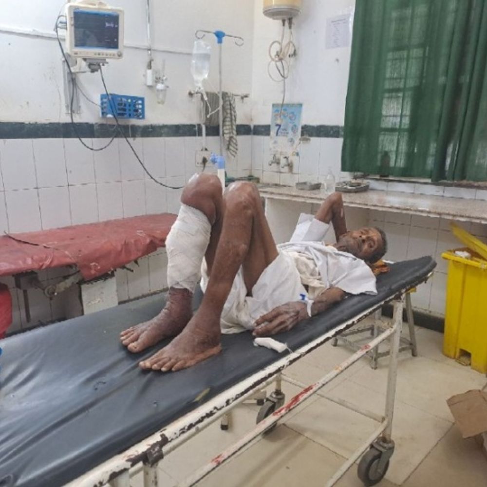 पाली में सांप के काटने से 3 घायल:काम कर रही युवती को, घर में सो रहे वृद्ध को सांप ने काटा