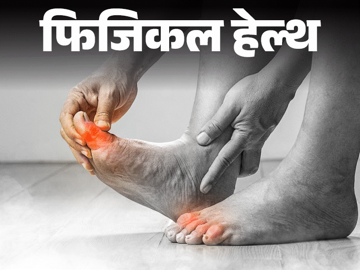 फिजिकल हेल्थ- हाई हील्स से टेढ़े हो सकते हैं पैर:दुनिया के 23% लोगों को बूनियन डिजीज, पुरुषों से ज्यादा रिस्क महिलाओं को