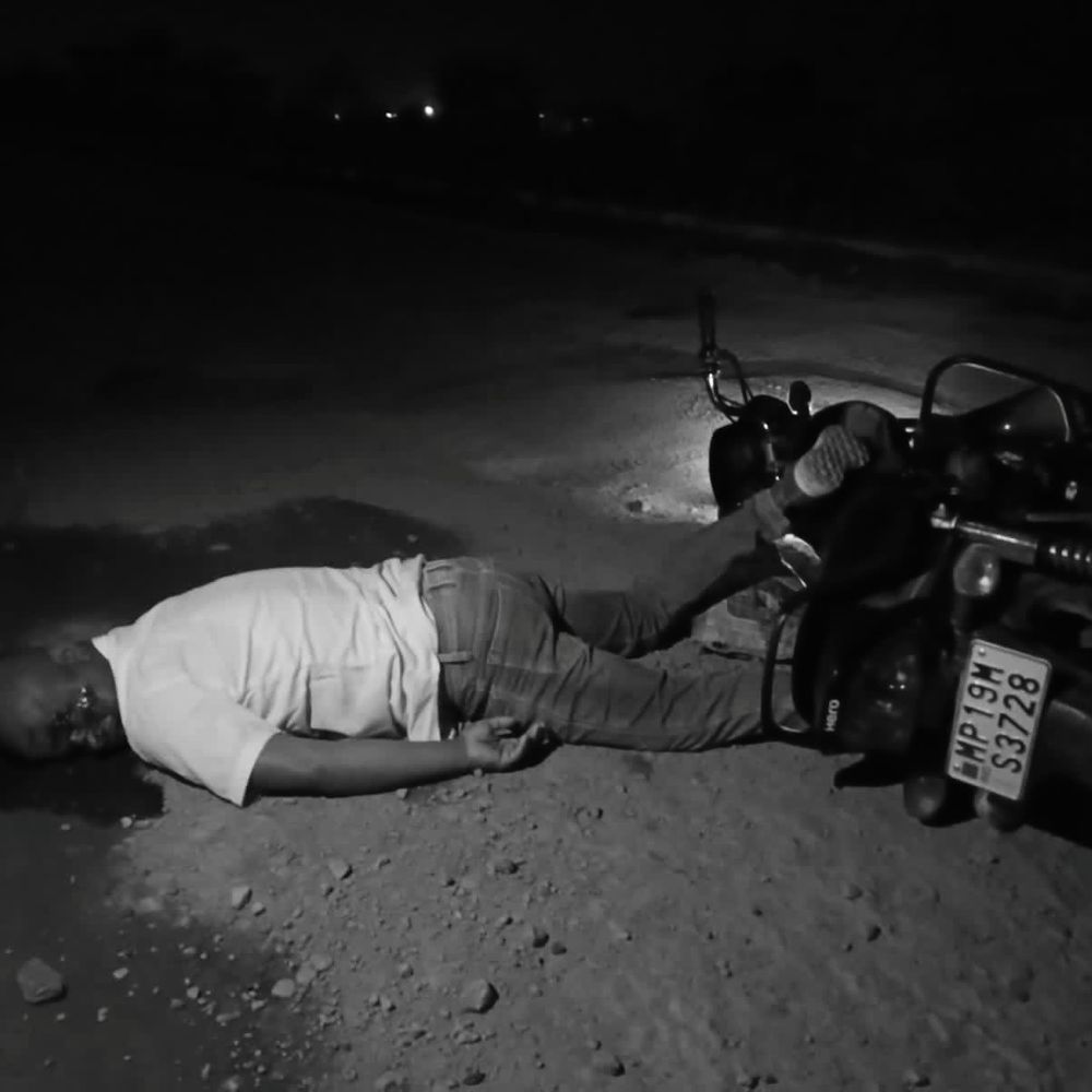 बगहा बाईपास पर सड़क हादसा, युवक घायल:परिजन जिला अस्पताल से निजी अस्पताल ले गए