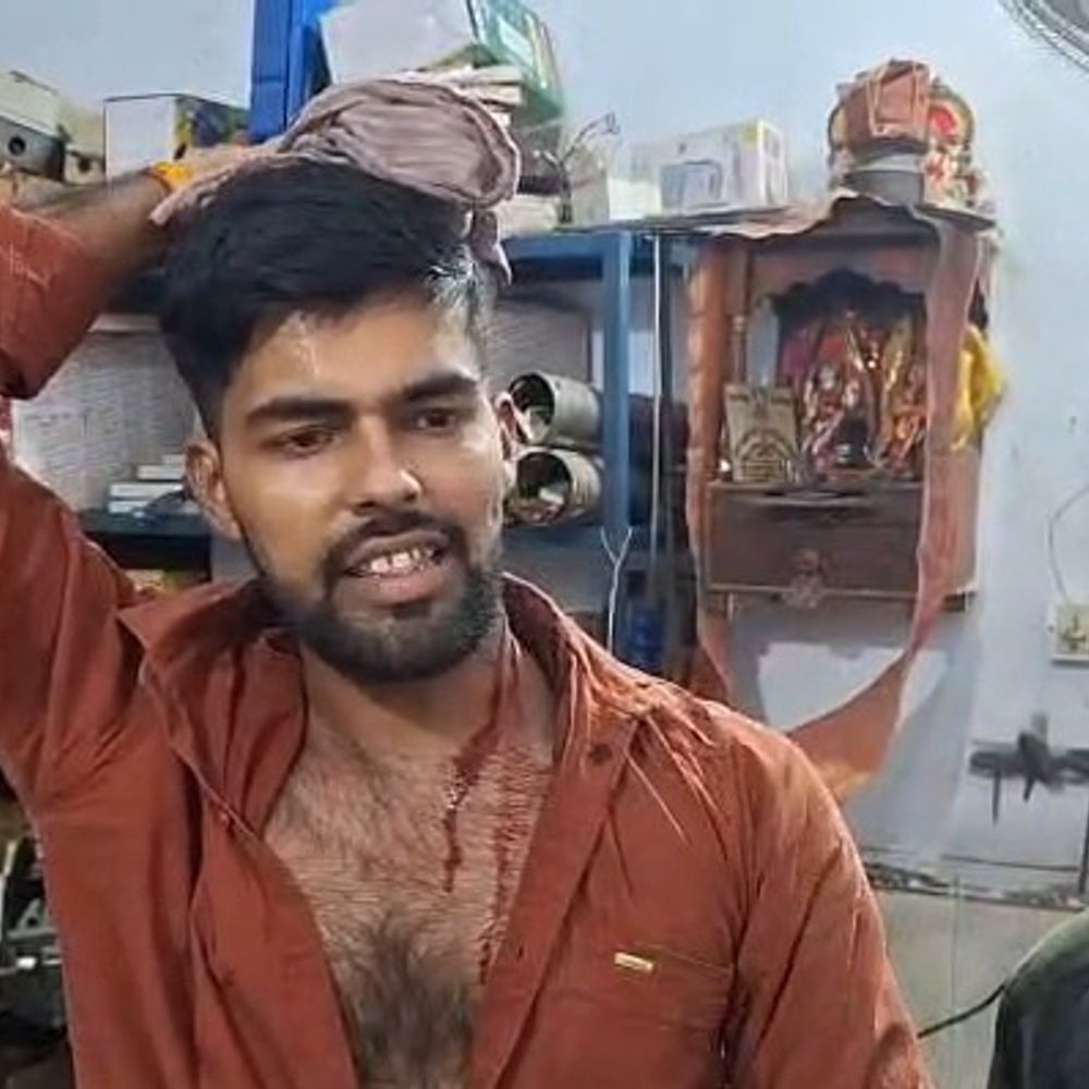 उन्नाव में गाड़ी की टक्कर के बाद मारपीट:तीन घायल, एक युवक का सिर फटा, पुलिस जांच में जुटी