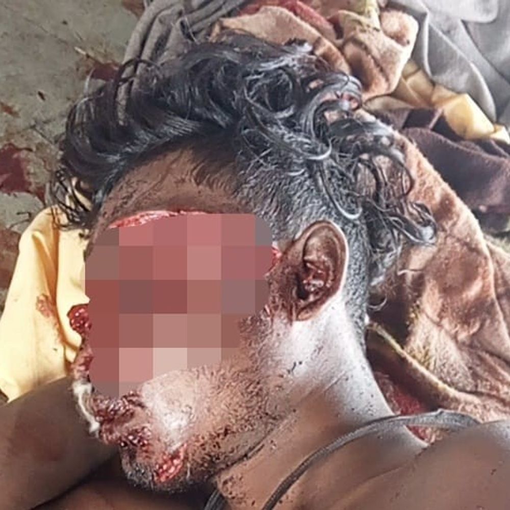 श्मशान में घायल युवक की मौत:आगरा में जानवर का हमला मान रही थी पुलिस, भाई ने दी तहरीर