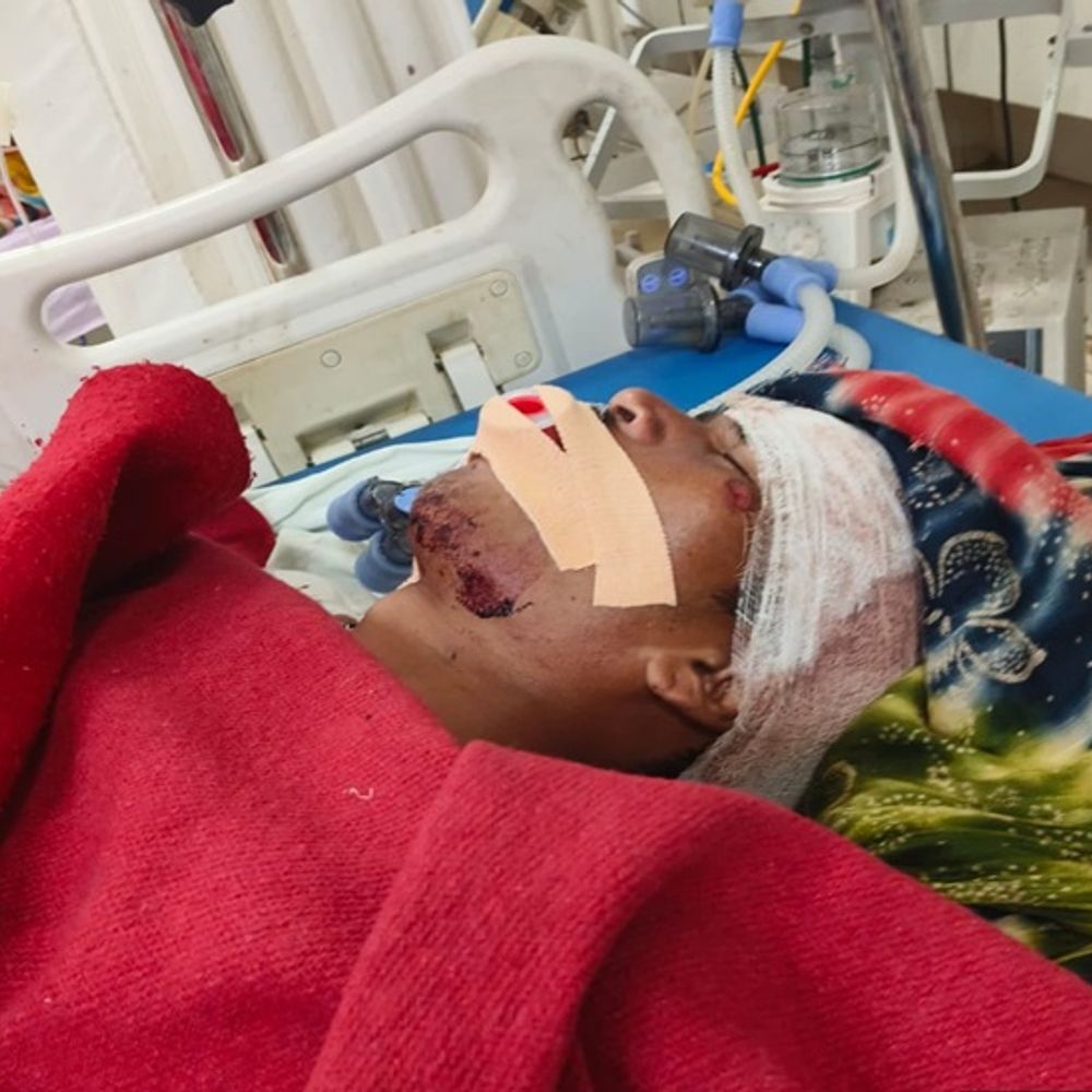 पहाड़ी कोरवा मरीज को 26 घंटे बाद मिल सकी एंबुलेंस:सड़क हादसे में घायल हुआ; परिजन बोले- अधिकारी प्रोटोकॉल का हवाला देकर नहीं दी गाड़ी