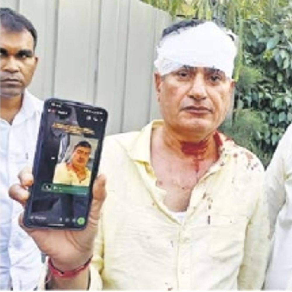 व्यावसायिक विवाद में जानलेवा हमला करने का आरोप, विधायकपुरी थाने में केस, जांच शुरू