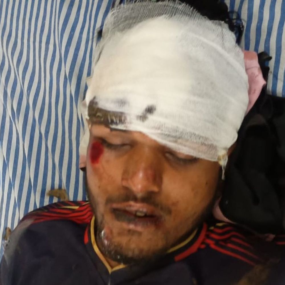 देवरिया में सड़क हादसा, एक युवक की मौत:दूसरा गंभीर घायल, गोरखपुर मेडिकल कॉलेज रेफर