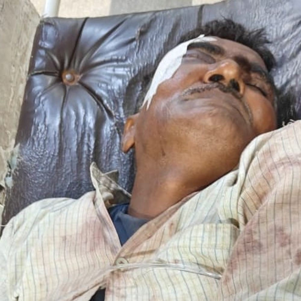 पशु को पत्थर मारने पर दो पक्ष भिड़े:ग्रेटर नोएडा में मारपीट में तीन घायल, 23 लोगों के खिलाफ केस दर्ज