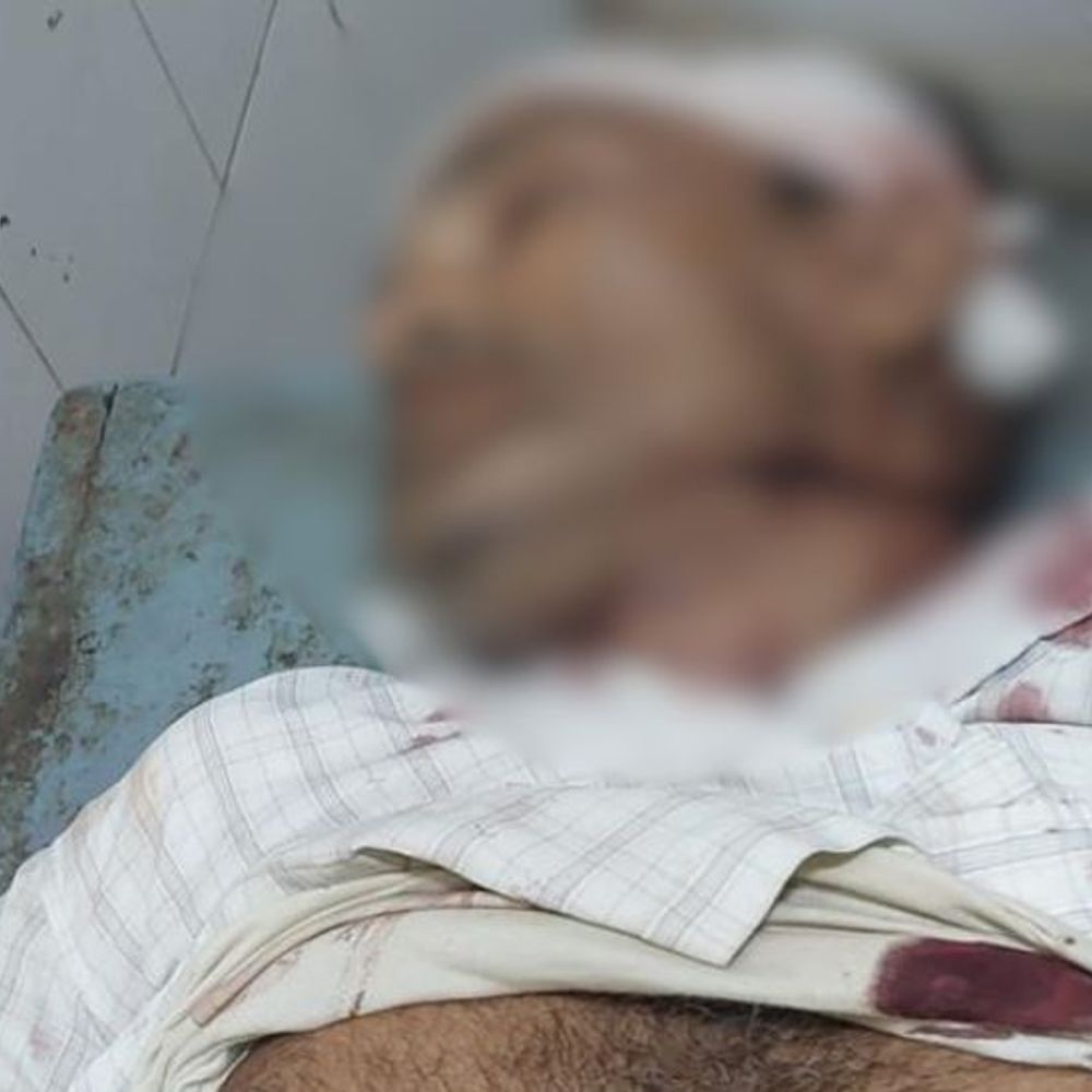 अमेठी में सड़क हादसे में युवक की मौत:बोलेरो ने बाइक को मारी थी टक्कर, चालक मौके से फरार