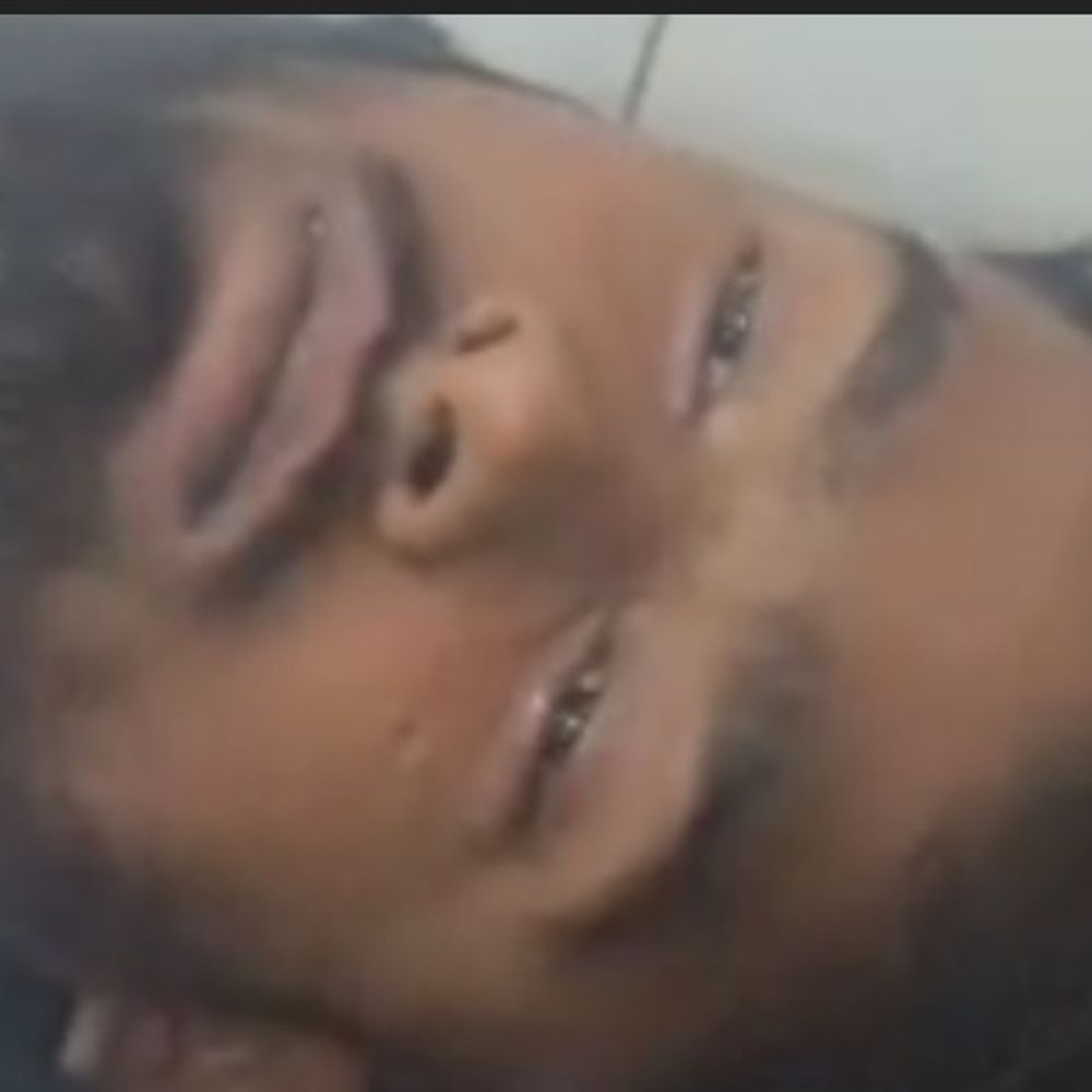 बस्ती में युवक पर चाकुओं से हमला:बांस का घेरा टूटने के बाद हुआ विवाद, दबंगों ने किया घायल