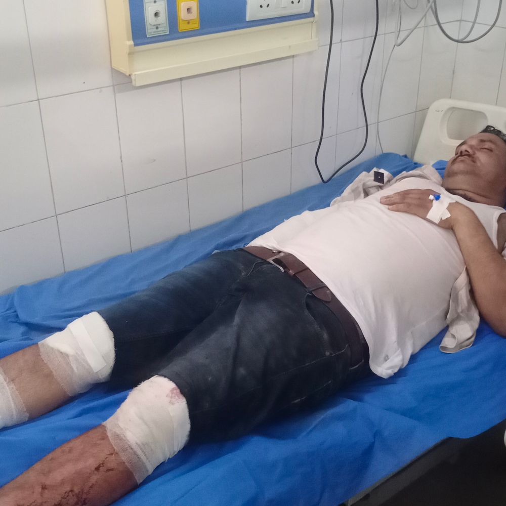 ललितपुर में पार्षद पर हमला, हाथ-पैर टूटे:दो साथियों पर भी हमला, फायरिंग का आरोप