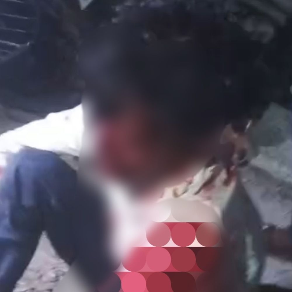 2 बाइक की टक्कर में महिला समेत 4 घायल:किशनगंज में दो की स्थिति नाजुक, 2 युवक की पहचान जारी