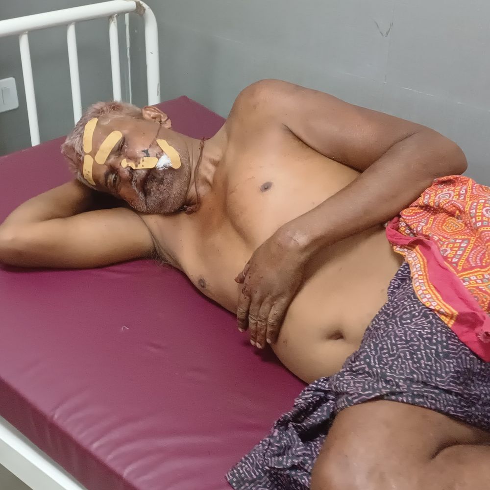 मुंगेर के गढ़ी रामपुर में मारपीट, 3 गंभीर घायल:अवैध शराब बिक्री रोकने पर बढ़ा विवाद, पीड़ित बोले-8-10 लोगों ने किया हमला