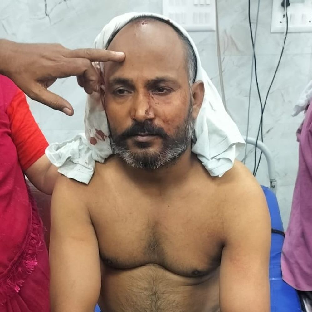 लखनऊ में वकील के सिर में गोली मारी:हालत गंभीर, पटाखा जलाने को लेकर पड़ोसियों में विवाद हुआ था