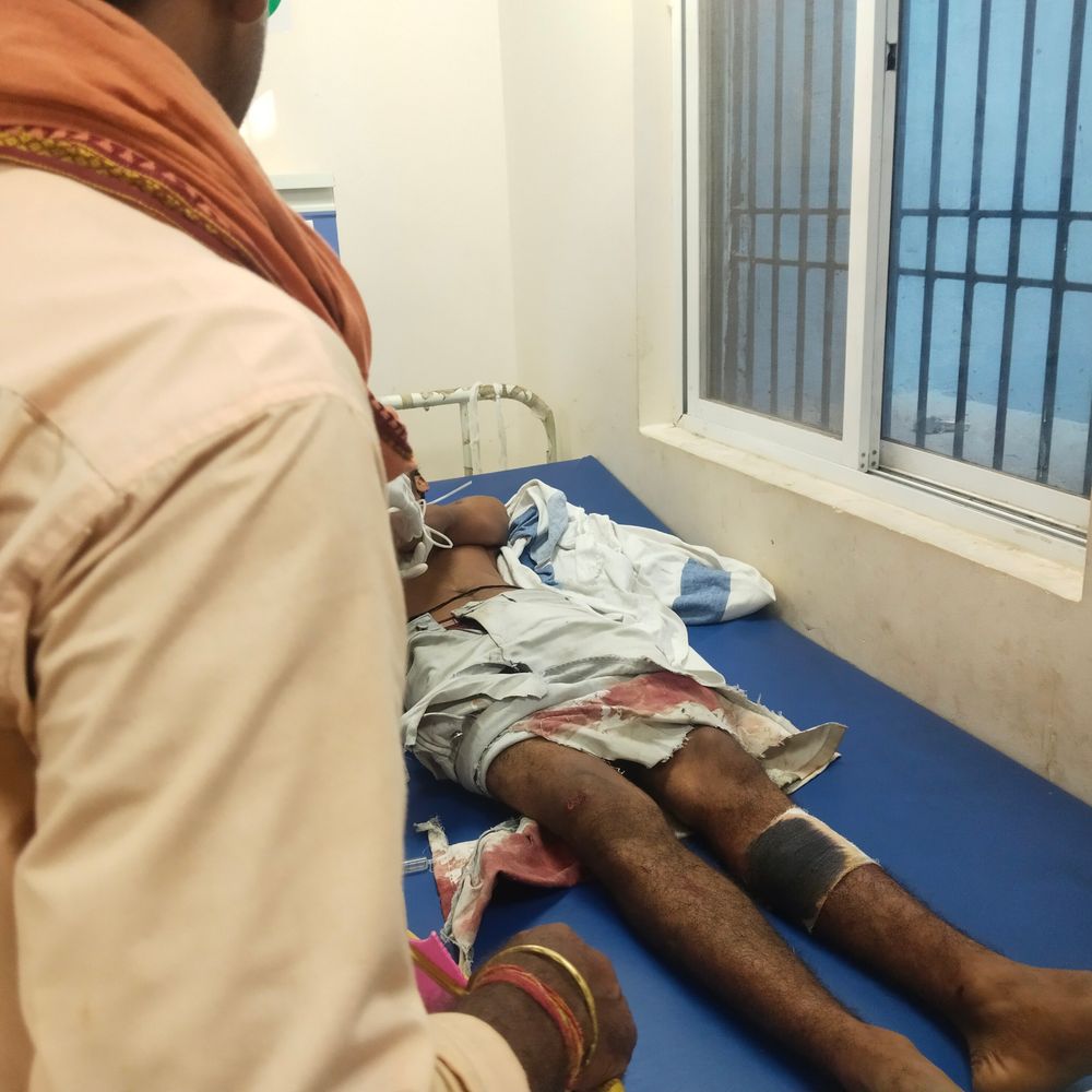 मधुबनी में 14 वर्षीय छात्र गंभीर रूप से घायल:  मोटरसाइकिल ने मारी टक्कर, सदर अस्पताल में इलाज जारी – Madhubani News