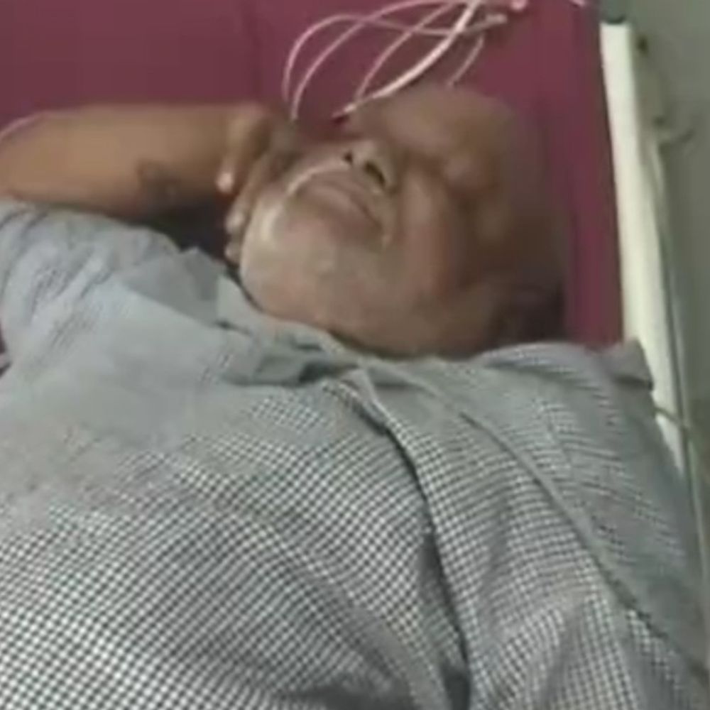 दिवाली के दिन कचरा फेंकने को लेकर जानलेवा हमला:बिलासपुर में 8-10 लोगों ने घर घुसकर पूर्व एल्डरमैन को मारा; गंभीर घायल