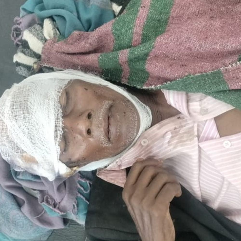 ओझा के शक में भतीजों ने चाचा पर किया हमला:  पलामू में गड़ासा से वार कर गंभीर रूप से घायल किया, पत्नी ने बचाई जान – Palamu News