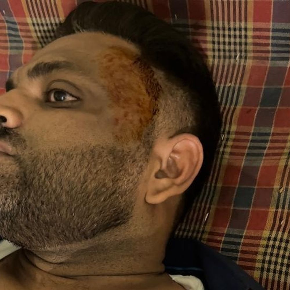कौशांबी में बहन की शादी के दीन भाई को पीटा:10 लोगों ने हमला किया, 4 घायल; सीसीटीवी में कैद हुई वारदात