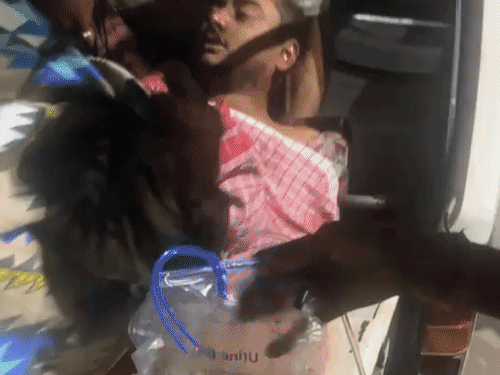 कानपुर में युवक पर चापड़ से हमला:पेट का आंते निकाली, हाथ का अंगूठा और उंगली कटी; सिर पर लगे 14 टांके