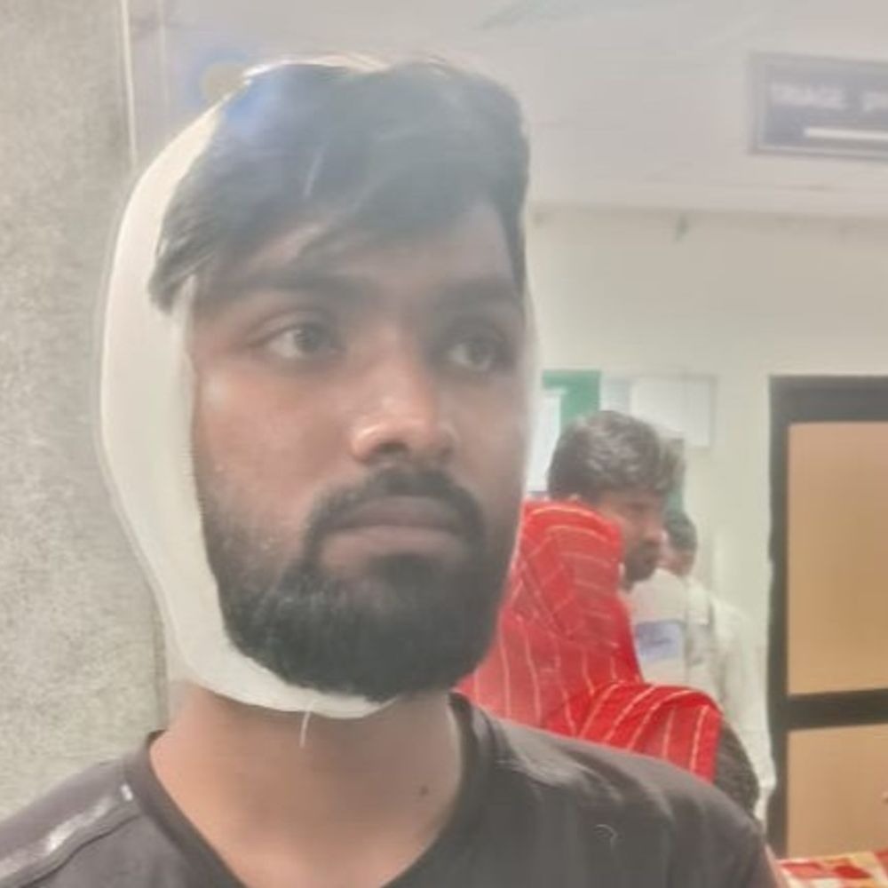 कलमा न पढ़ने पर एएमयू के हिंदू छात्र को पीटा:सिटी स्कूल में 11वीं का छात्र है पीड़ित, पिस्टल की बट मारकर घायल करने का आरोप