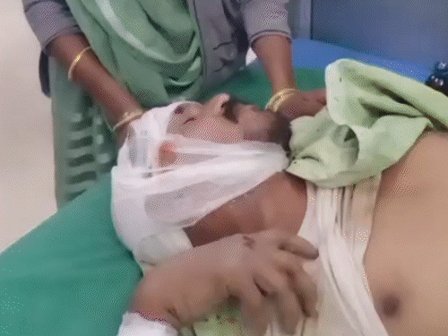 ललितपुर DM डुली की स्कॉर्ट गाड़ी ने दिव्यांग को कुचला:तीन बाइकों को मारी टक्कर, खंभे से टकराई; भीड़ ने ड्राइवर-होमगार्ड को पीटा