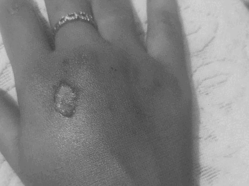 लुधियाना में लुटेरों का आतंक:  स्कूटी सवार दो बहनों से पर्स छीना,सड़क पर गिरीं,गंभीर चोटें आईं – Ludhiana News