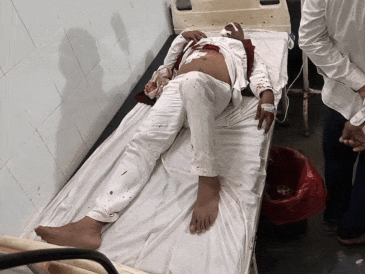 आगरा में कांग्रेस नेता और भाई पर हमला:शादी से लौटते समय मारी गोली, दोनों गंभीर घायल