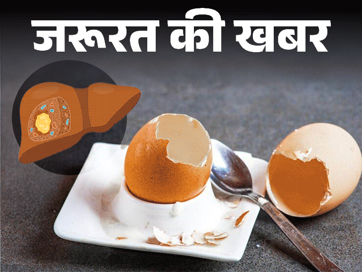 जरूरत की खबर- खराब अंडे से लिवर एब्सेस का रिस्क:जानें क्या है ये बीमारी, कितनी खतरनाक, सही और खराब अंडे की पहचान कैसे करें
