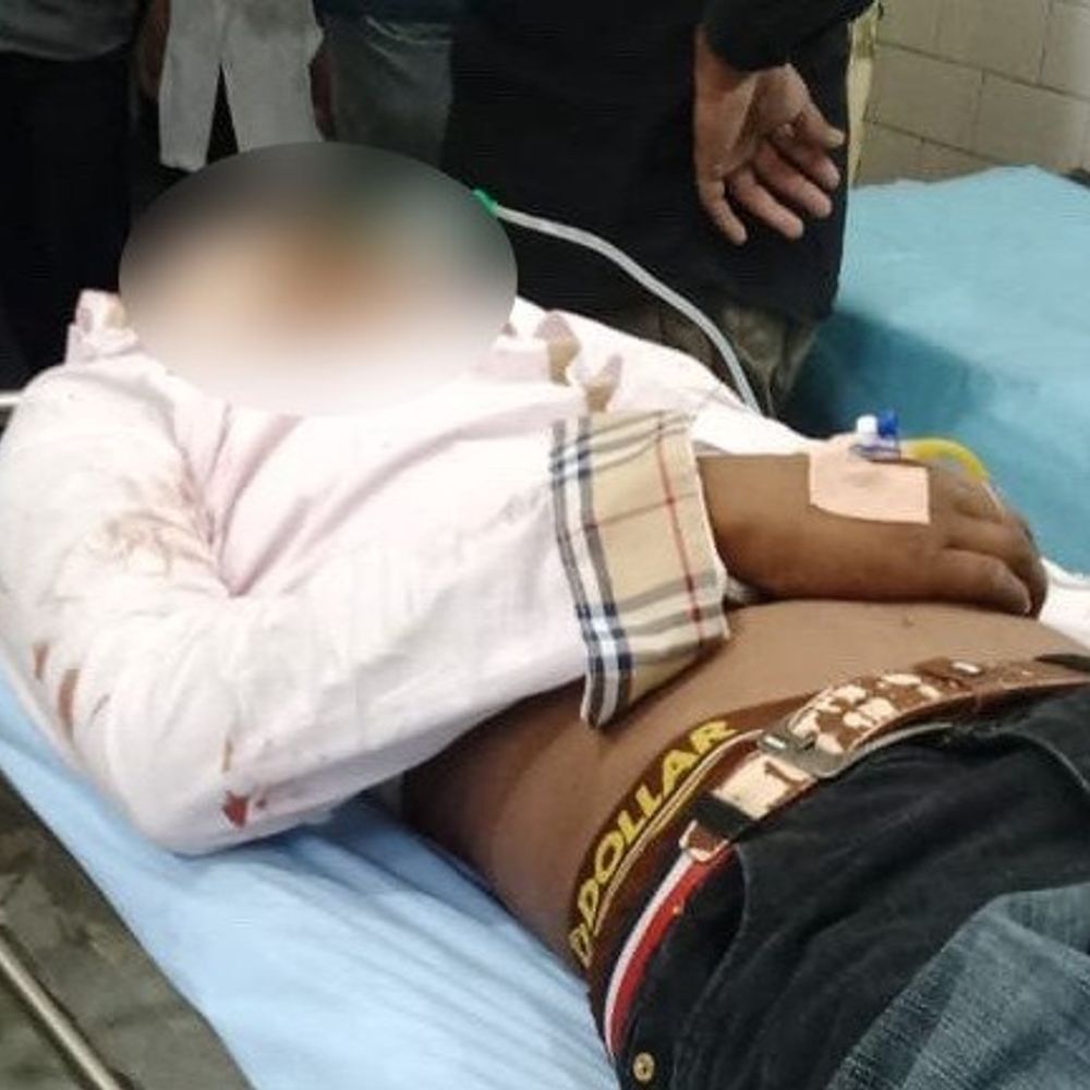 बरनाला में एक्सीडेंट में युवक की मौत:  दो घायल, तीनों बाइक से जा रहे थे, आगे चल रही ट्रैक्टर-ट्राली से टकराए – Barnala News