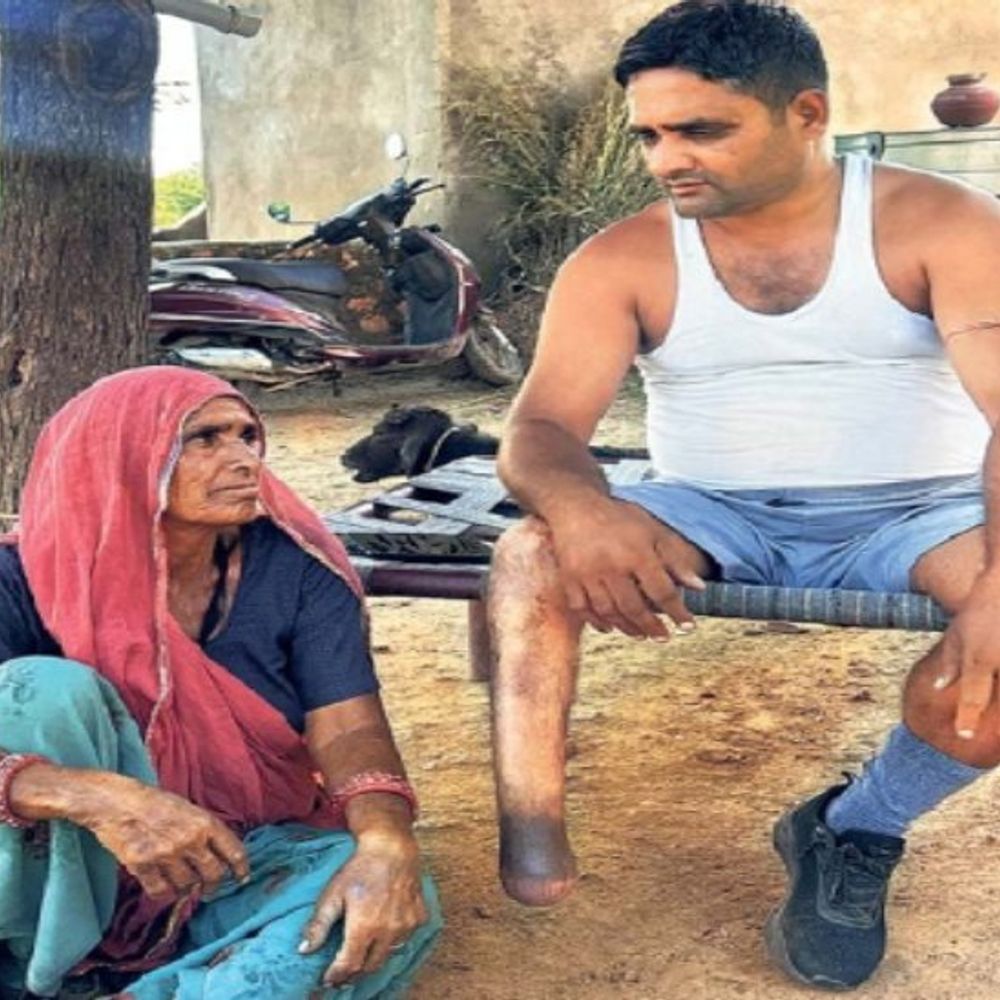 मणिपुर में आतंकियों ने आईईडी ब्लास्ट किया, मेरी धड़कनें रुक गई थीं, अंडकोष फटा-पैर कटा, पर सरकार नहीं मानती विकलांग