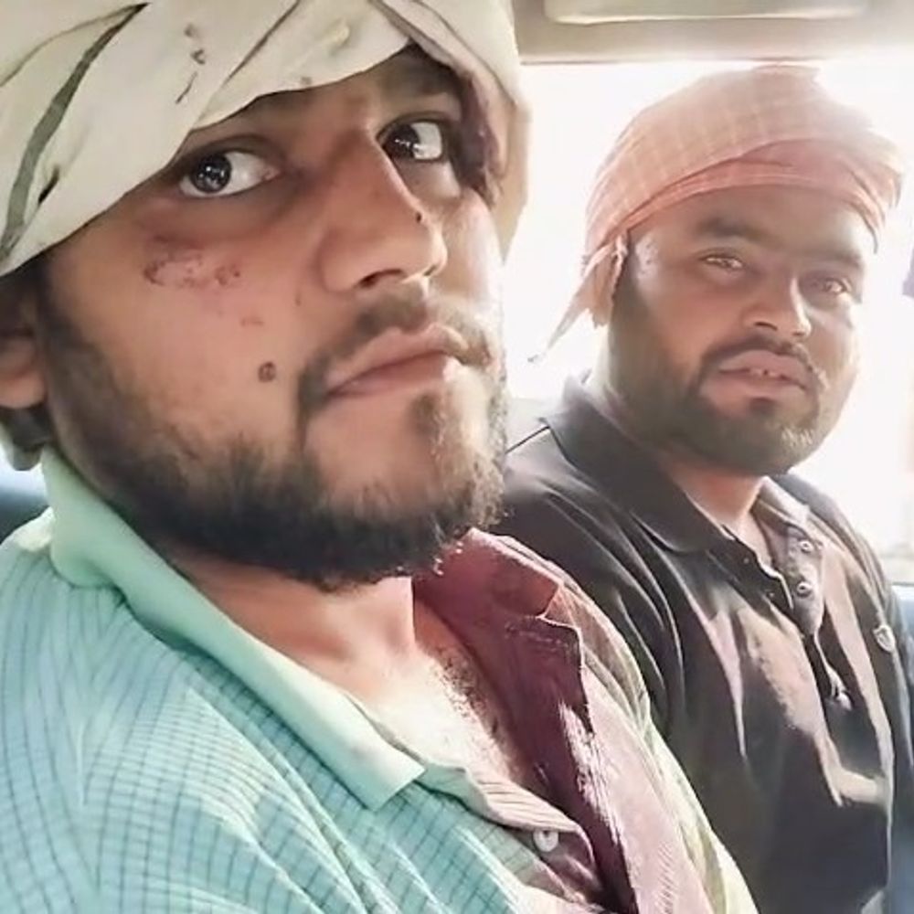 मथुरा के औधूता में बाइक विवाद, फायरिंग में युवक घायल:दो पक्षों में लाठी-डंडे चले, चार घायल; पुलिस जांच में जुटी