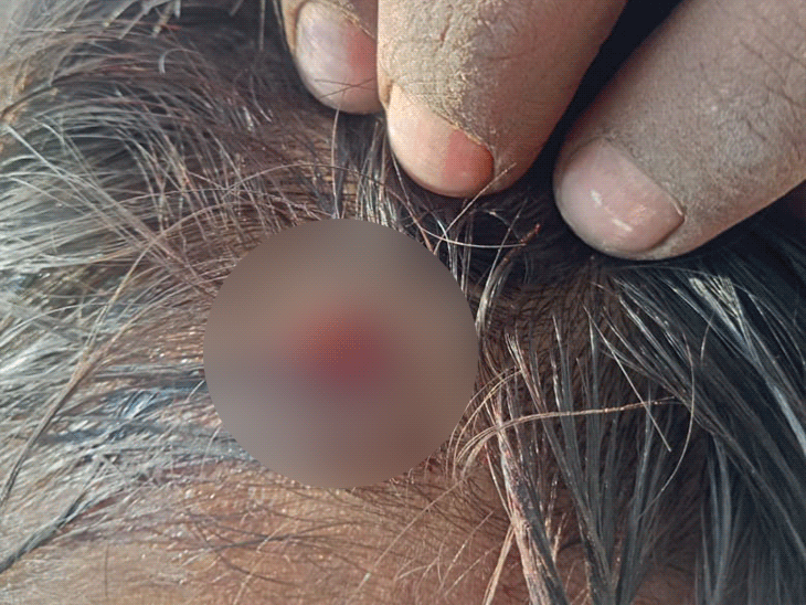 हिमाचल में लोहे के स्केल से पीटा बच्चा लहूलुहान:  सिर पर गहरी चोट; काफी मात्रा में खून बहा, शिकायत लेकर पुलिस चौकी पहुंचे परिजन – Shimla News