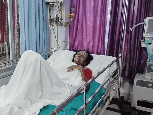 विद्यार्थी मार्केट में सिलेंडर में लगी आग से हड़कंप:आग की लपटों में घिरने से दंपत्ति झुलसे, दमकल की एक गाड़ी ने आधे घंटे में पाया काबू