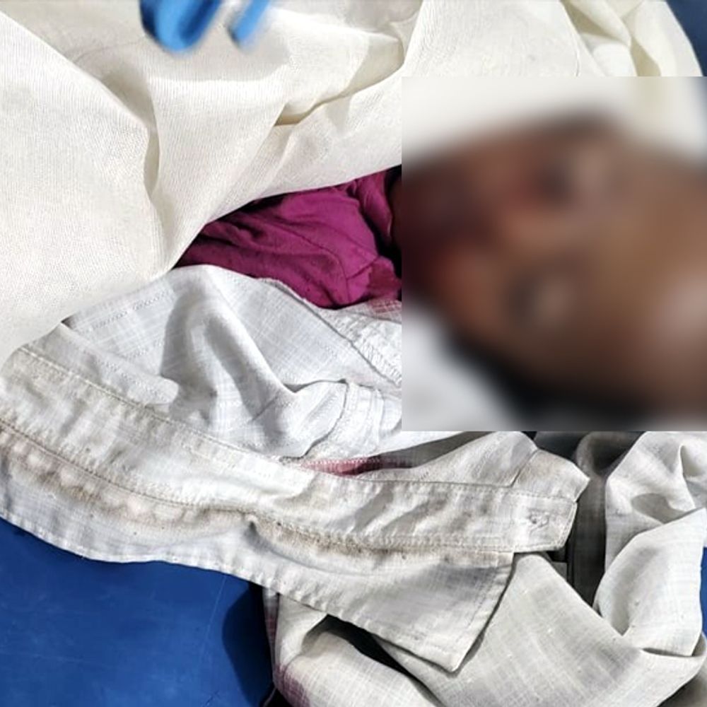 कोडरमा में बाइक गिरने से बच्चे की मौत:  खेलते समय हादसे का हुआ शिकार, चेहरे पर आई थी गंभीर चोट – koderma News