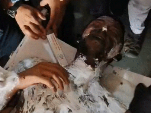 DAV कॉलेज में छात्र ने खुद को आग लगाई:मुजफ्फरनगर में फीस न देने पर प्रिंसिपल ने परीक्षा में नहीं बैठने दिया था