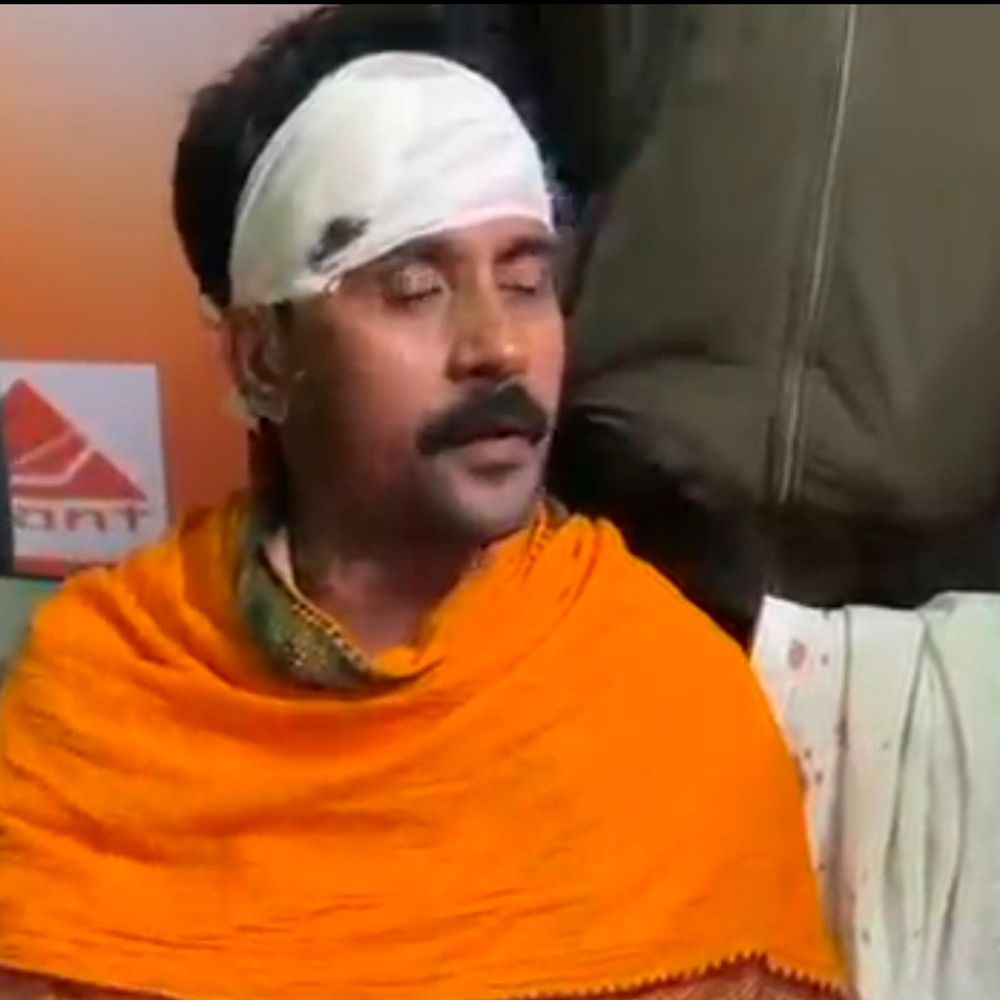 राघोपुर में दुकानदार पर चाकू से हमला:  दुकान बंद कर लौटते समय अज्ञात बाइक सवारों ने वार किया, अस्पताल में भर्ती – Birpur(Supaul ) News