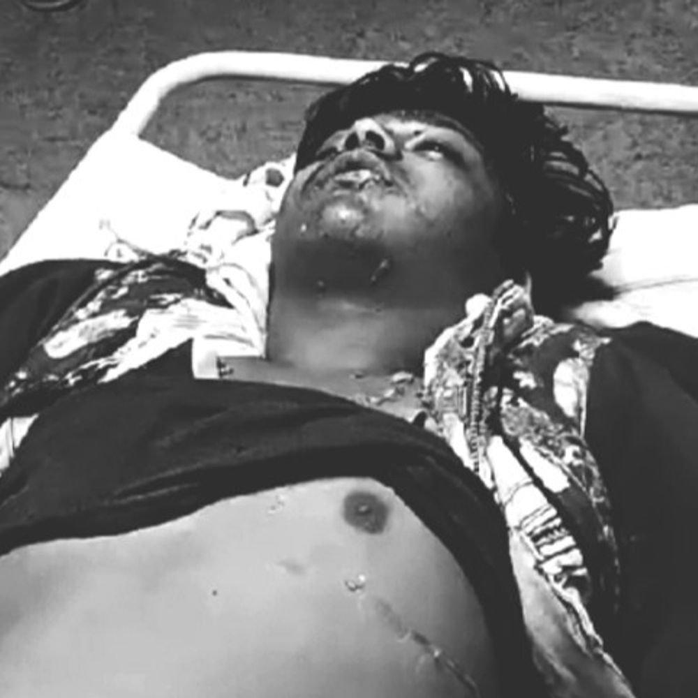 छिंदवाड़ा में कार की टक्कर से बाइक सवार की मौत:एक साल पहले हुई थी शादी, बड़े भाई की भी सड़क हादसे में मौत हो चुकी