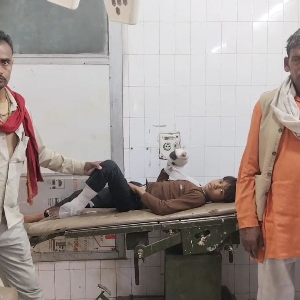10 साल के बच्चे के हाथ में सेल फटा:महोबा में खेलते समय हादसा, हायर सेंटर रेफर