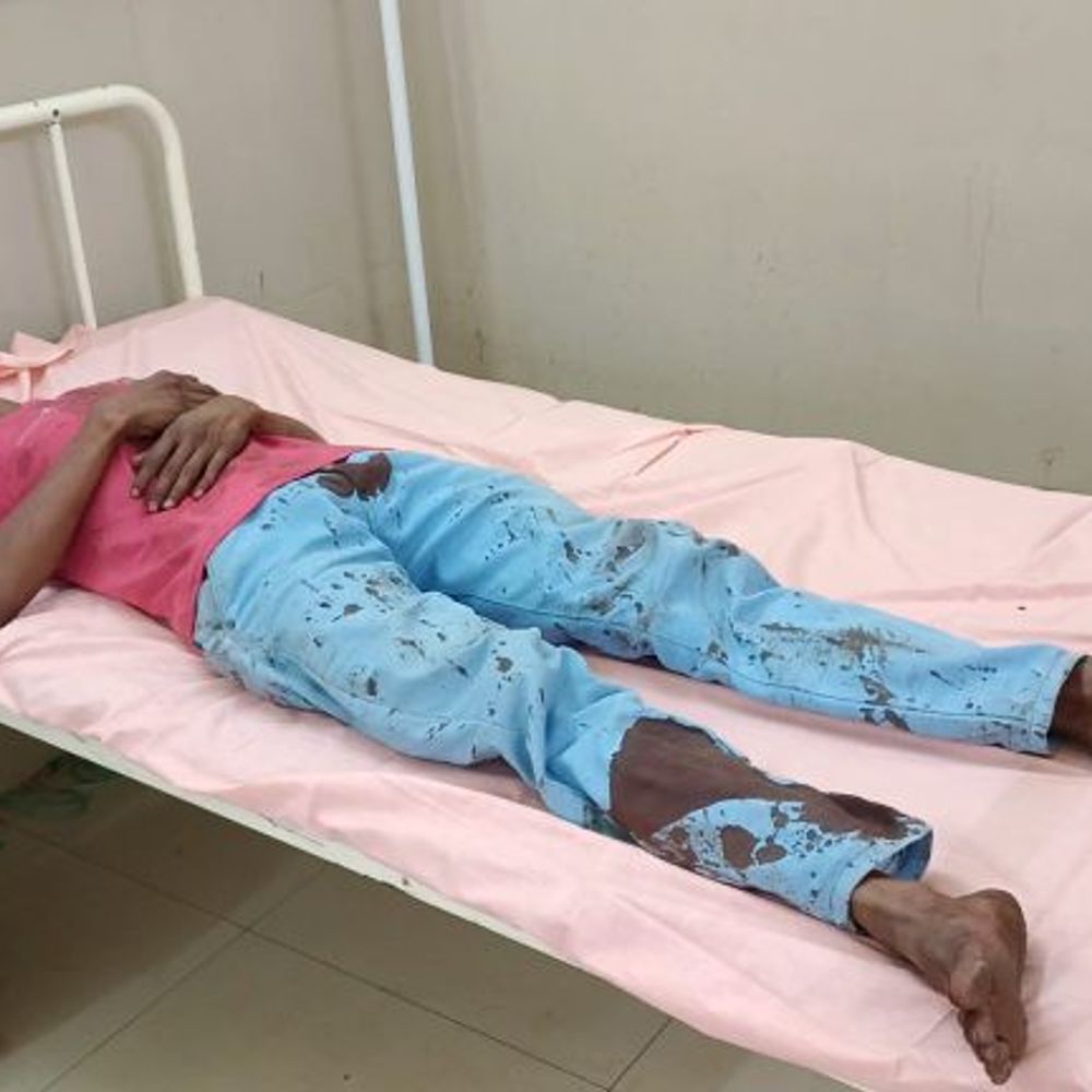 फतेहपुर में पत्नी ने पति के सिर पर ईंट मारी:शादी से लौटते के बाद विवाद, पति गंभीर घायल