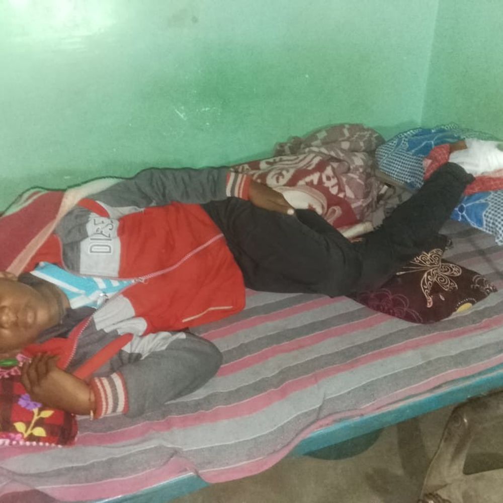 कोडरमा में विस्फोटक से बच्चा गंभीर रूप से घायल:  जानवर पकड़ने के लिए जमीन में छिपाकर रखे थे एक्सप्लोसिव – koderma News