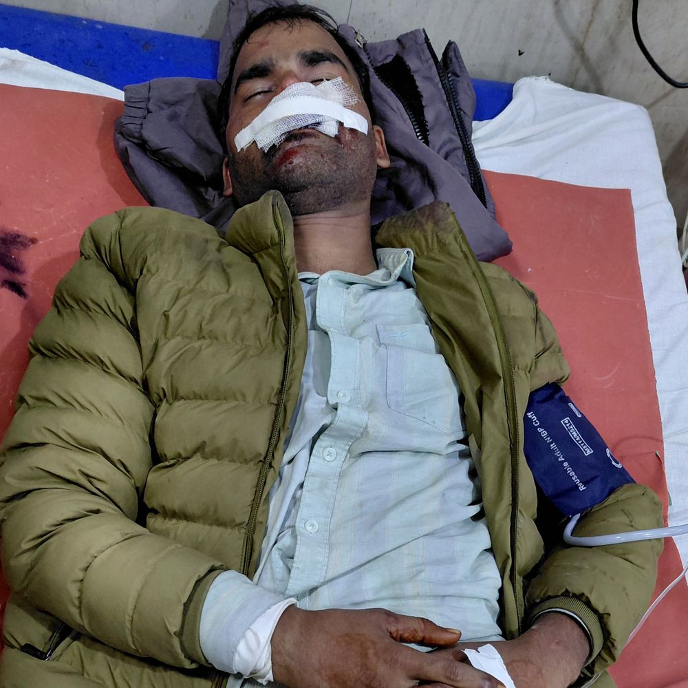 फर्रुखाबाद में शादी के दिन दूल्हा घायल:मांझे से चेहरे पर लगी गहरी चोट, बाजार से शॉपिंग कर लौट रहा था घर