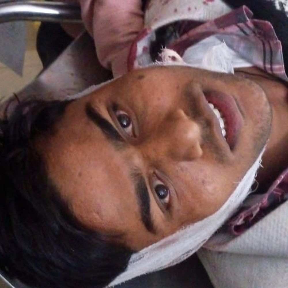 फफूंदी लगी मिठाई की शिकायत पर हमला:देवरिया में दुकानदार ने दूल्हे को पीटा, चेन-अंगूठी लूटी; दो घायल