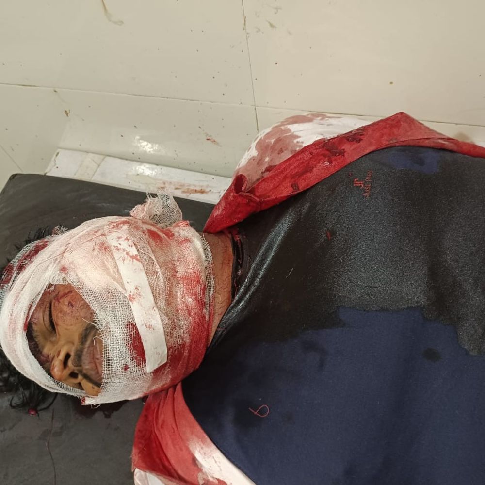 शराबी युवक ने झोलाछाप का चापड़ से कान काटा:राहगीरों ने आरोपी को पकड़कर पुलिस को सौंपा